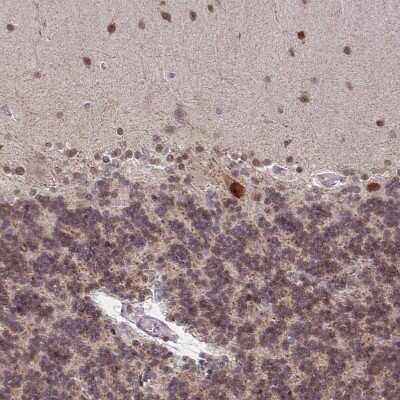 Immunohistochemistry-Paraffin: BRD3 Antibody [NBP2-14360]