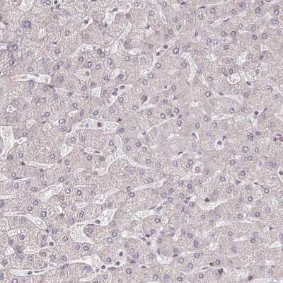 Immunohistochemistry-Paraffin: BRD3 Antibody [NBP2-14360]