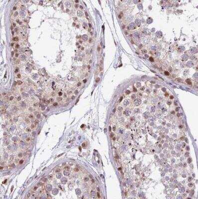 Immunohistochemistry-Paraffin: BRD3 Antibody [NBP2-14360]