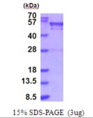 SDS-PAGE: Recombinant Human BRD3 His Protein [NBP2-51919]