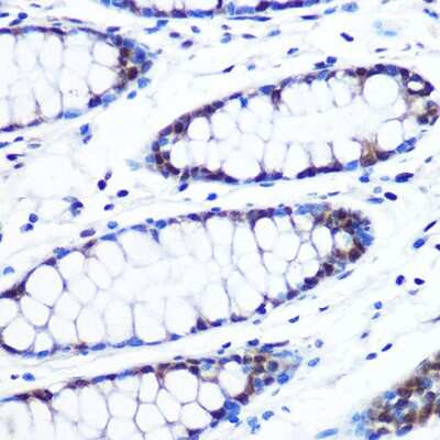 Immunohistochemistry-Paraffin: BRD4 Antibody (7L7M8) [NBP3-15452]