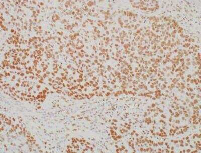 Immunohistochemistry-Paraffin: BRD4 Antibody (BL-149-2H5) [NBP2-76393]