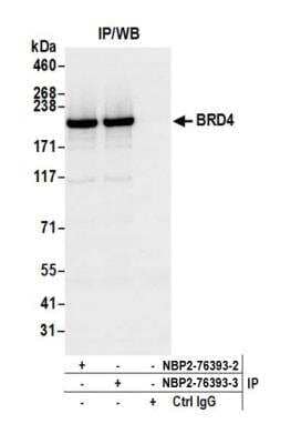 Immunoprecipitation: BRD4 Antibody (BL-149-2H5) [NBP2-76393]