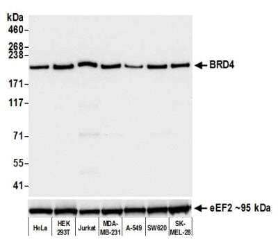 Western Blot: BRD4 Antibody (BL-149-2H5) [NBP2-76393]
