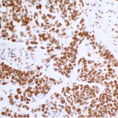 Immunohistochemistry-Paraffin: BRD4 Antibody (BL-151-6F11) [NBP2-76394]