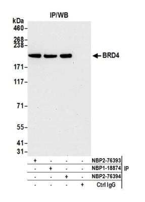 Immunoprecipitation: BRD4 Antibody (BL-151-6F11) [NBP2-76394]