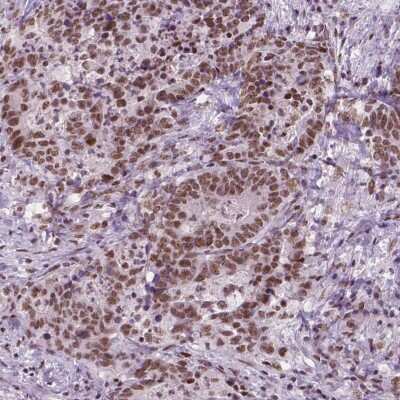 Immunohistochemistry-Paraffin: BRD4 Antibody (CL1115) [NBP2-52958]