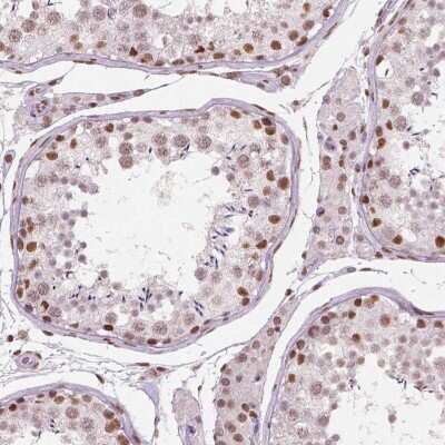 Immunohistochemistry-Paraffin: BRD4 Antibody (CL1115) [NBP2-52958]