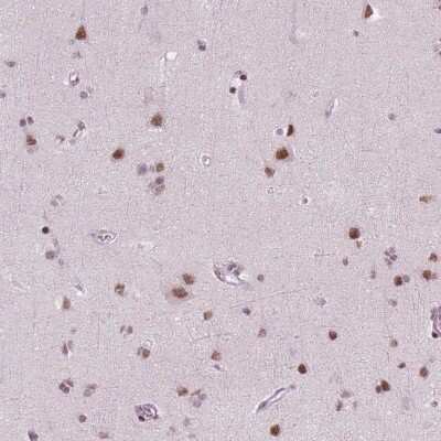 Immunohistochemistry-Paraffin: BRD4 Antibody (CL1115) [NBP2-52958]