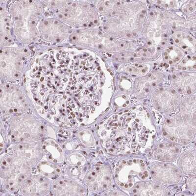 Immunohistochemistry-Paraffin: BRD4 Antibody (CL1115) [NBP2-52958]