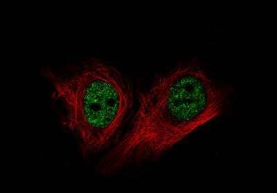 Immunocytochemistry/ Immunofluorescence: BRD4 Antibody (CL1118) [NBP2-52959]