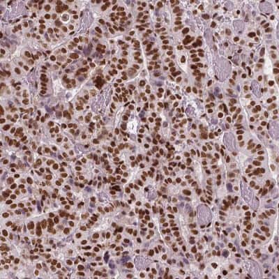 Immunohistochemistry-Paraffin: BRD4 Antibody (CL1118) [NBP2-52959]