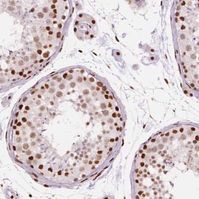 Immunohistochemistry-Paraffin: BRD4 Antibody (CL1118) [NBP2-52959]