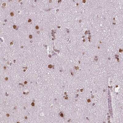 Immunohistochemistry-Paraffin: BRD4 Antibody (CL1118) [NBP2-52959]