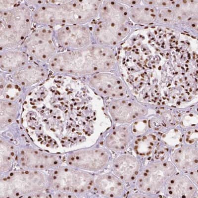 Immunohistochemistry-Paraffin: BRD4 Antibody (CL1118) [NBP2-52959]