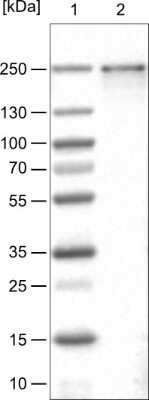 Western Blot: BRD4 Antibody (CL1118) [NBP2-52959]