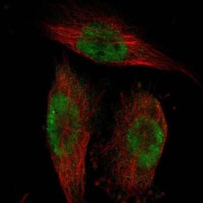 Immunocytochemistry/ Immunofluorescence: BRD4 Antibody [NBP1-86640]