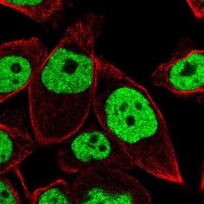 Immunocytochemistry/ Immunofluorescence: BRD4 Antibody [NBP2-38931]