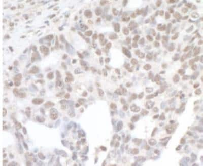 Immunohistochemistry-Paraffin: BRD4 Antibody [NBP1-18874]