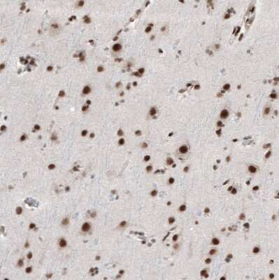 Immunohistochemistry-Paraffin: BRD4 Antibody [NBP1-86640]