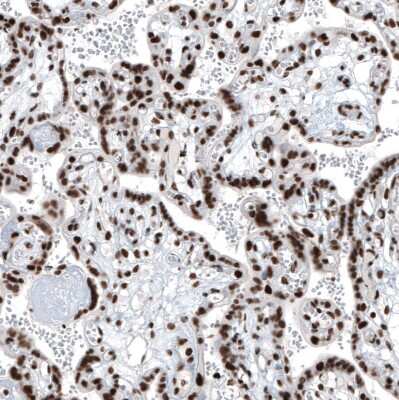 Immunohistochemistry-Paraffin: BRD4 Antibody [NBP1-86640]