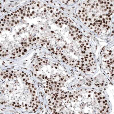 Immunohistochemistry-Paraffin: BRD4 Antibody [NBP1-86640]