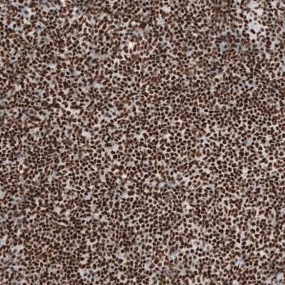 Immunohistochemistry-Paraffin: BRD4 Antibody [NBP1-86640]