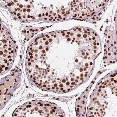 Immunohistochemistry-Paraffin: BRD4 Antibody [NBP2-38931]