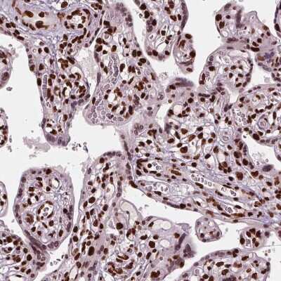 Immunohistochemistry-Paraffin: BRD4 Antibody [NBP2-38931]
