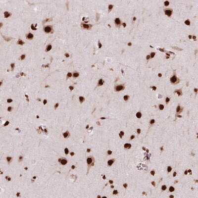 Immunohistochemistry-Paraffin: BRD4 Antibody [NBP2-38931]