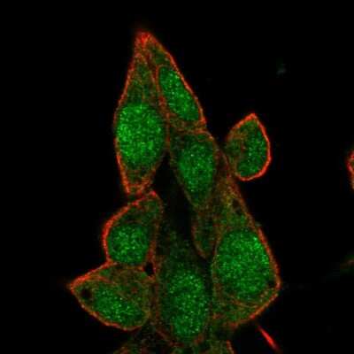 Immunocytochemistry/ Immunofluorescence: BRD7 Antibody [NBP2-55751]