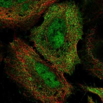 Immunocytochemistry/ Immunofluorescence: BRD7 Antibody [NBP2-59009]