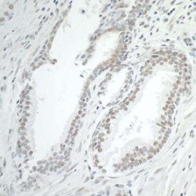 Immunohistochemistry-Paraffin: BRD7 Antibody [NBP1-28727]