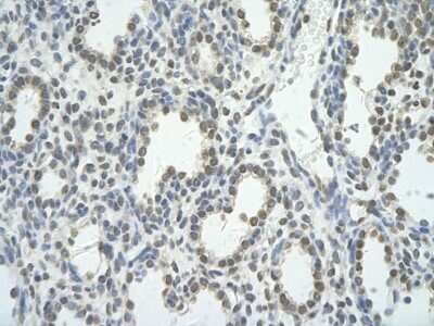 Immunohistochemistry-Paraffin: BRD7 Antibody [NBP2-87080]