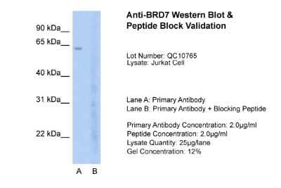 Western Blot: BRD7 Antibody [NBP2-87080]