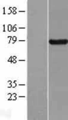 Western Blot: BRD7 Overexpression Lysate [NBL1-08024]