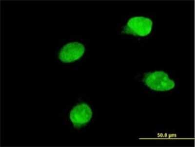 Immunocytochemistry/ Immunofluorescence: BRD8 Antibody (3G8) [H00010902-M01]