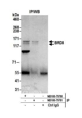 Immunoprecipitation: BRD8 Antibody [NB100-79780]