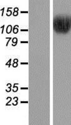 Western Blot: BRD8 Overexpression Lysate [NBP2-05580]