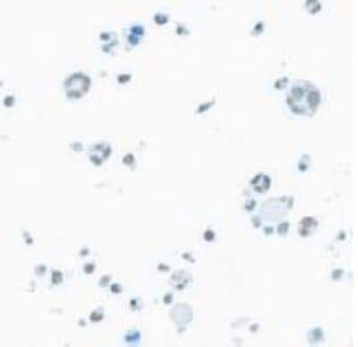 Immunocytochemistry/ Immunofluorescence: BRD9 Antibody (BLR153J) [NBP3-14730]