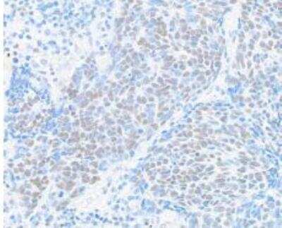 Immunohistochemistry-Paraffin: BRD9 Antibody (BLR153J) [NBP3-14730]