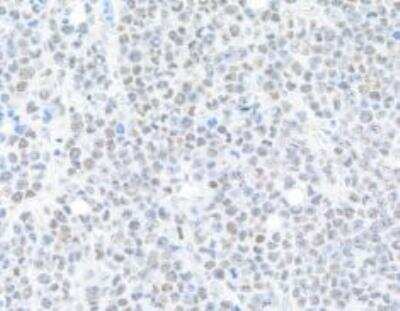 Immunohistochemistry-Paraffin: BRD9 Antibody (BLR153J) [NBP3-14730]