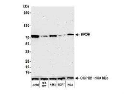 Western Blot: BRD9 Antibody (BLR153J) [NBP3-14730]