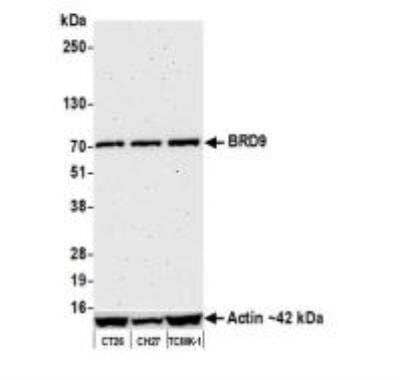 Western Blot: BRD9 Antibody (BLR153J) [NBP3-14730]