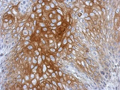 Immunohistochemistry-Paraffin: BRD9 Antibody [NBP2-15614]