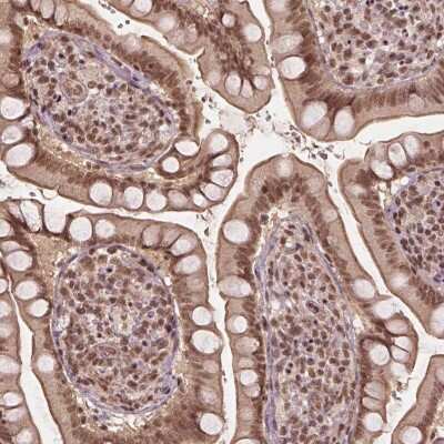 Immunohistochemistry-Paraffin: BRD9 Antibody [NBP2-58517]