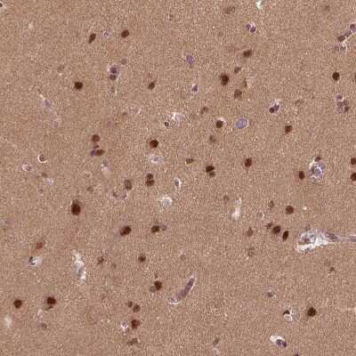 Immunohistochemistry-Paraffin: BRD9 Antibody [NBP2-58517]