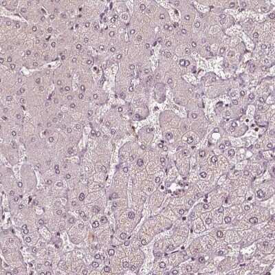 Immunohistochemistry-Paraffin: BRD9 Antibody [NBP2-58517]