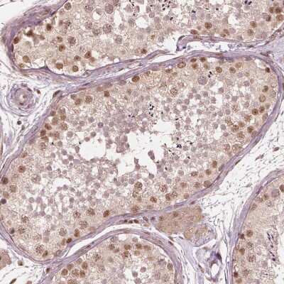 Immunohistochemistry-Paraffin: BRD9 Antibody [NBP2-58517]