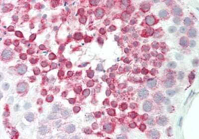 Immunohistochemistry-Paraffin: BRD9 Antibody [NBP2-87083]